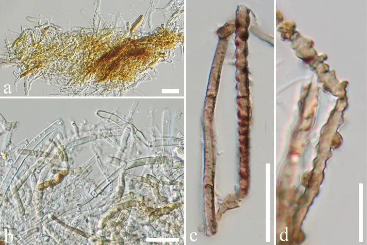 Dokumentasi Endomelanconiopsis freycinetiae — Pelat ilmiah