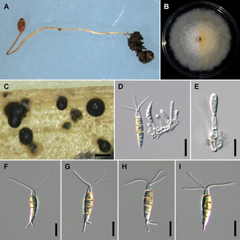 Dokumentasi Pestalotiopsis hispanica — Pelat ilmiah