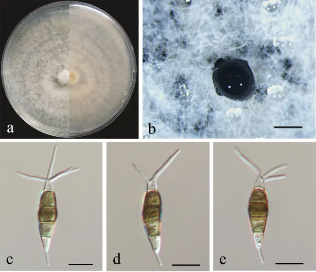 Dokumentasi Pestalotiopsis trachycarpicola — Pelat ilmiah