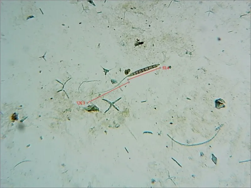 Dokumentasi Camposporium pellucidum — Fotografi