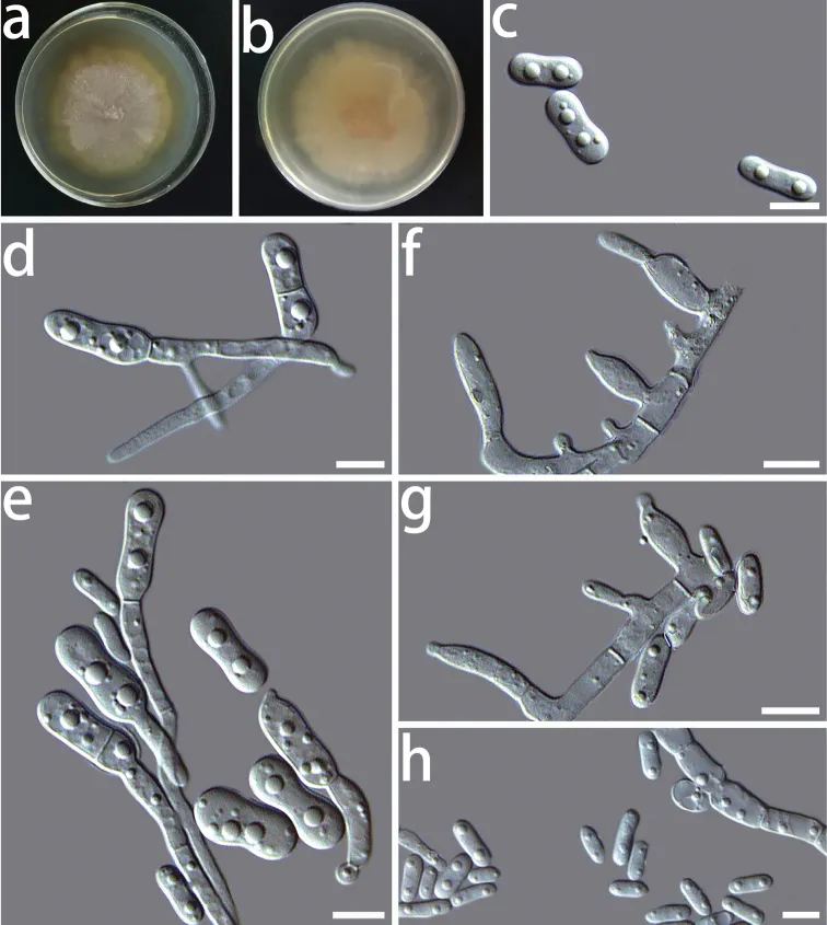 Dokumentasi Coniochaeta fibrosae — Pelat ilmiah