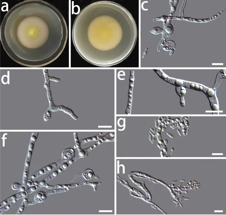 Dokumentasi Coniochaeta sinensis — Pelat ilmiah