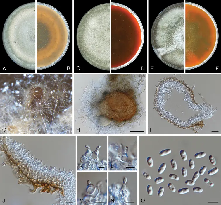 Dokumentasi Vandijckomycella joseae — Pelat ilmiah