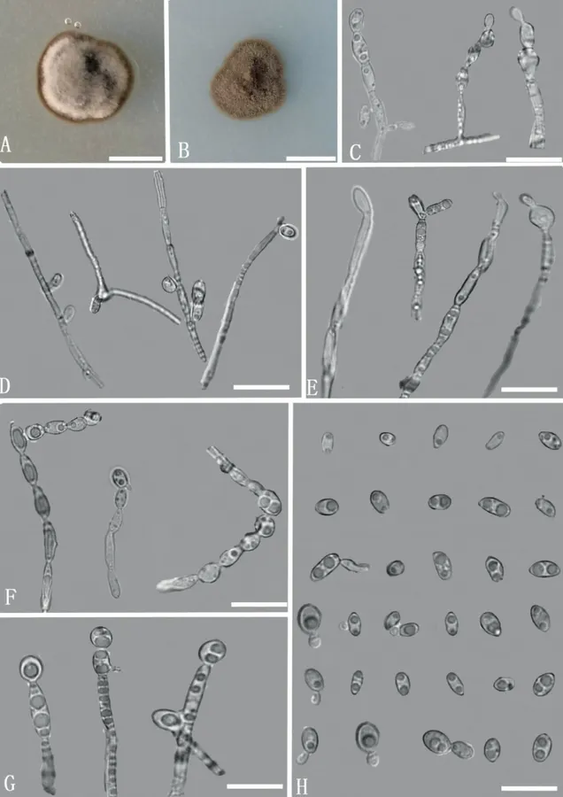 Dokumentasi Exophiala yunnanensis — Pelat ilmiah