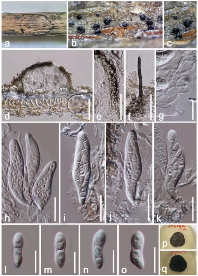 Dokumentasi Cyphellophora hongheensis — Pelat ilmiah