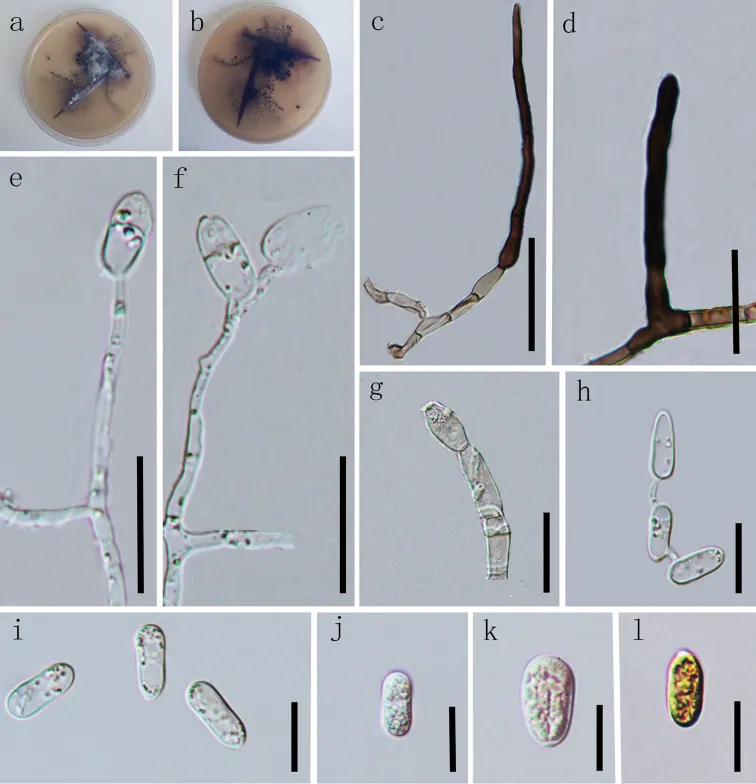 Dokumentasi Colletotrichum tongrenense — Pelat ilmiah