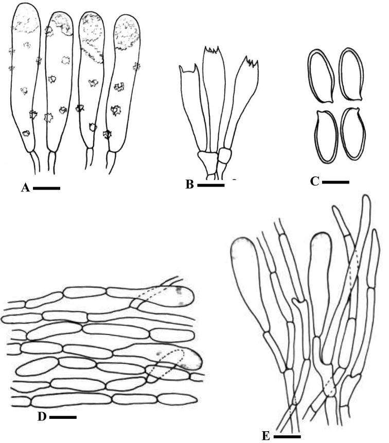 Gambar garis basidia, sistidia, spora dan hifa Chroogomphus pruinosus