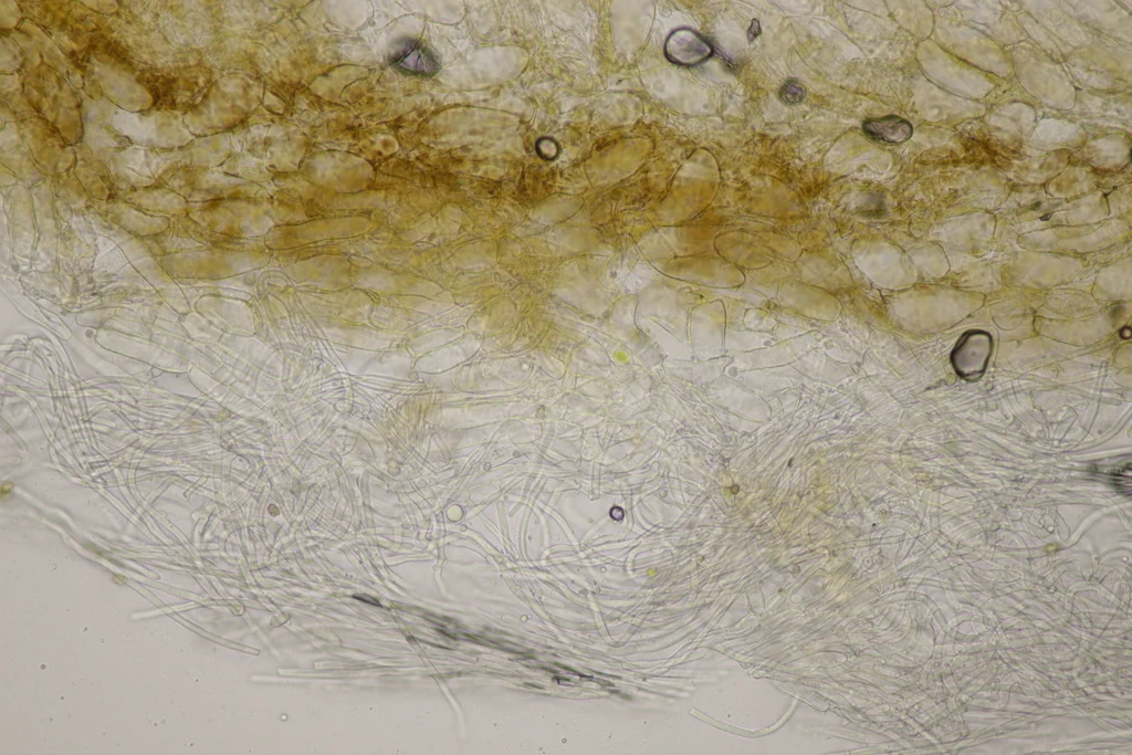 Mikrograf struktur yang diasosiasikan dengan Inocybe petiginosa pada iNaturalist