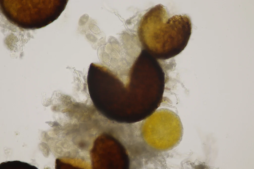 Mikrograf struktur yang diasosiasikan dengan Erysiphe convolvuli pada iNaturalist