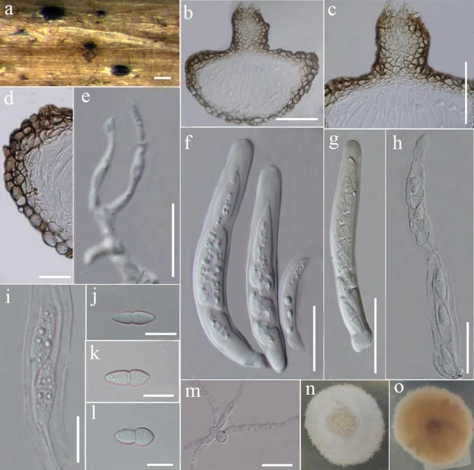 Pelat askoma, askus, askospora dan kultur pada sumber bernama Ascochyta pisi, alias profil Didymella pisi