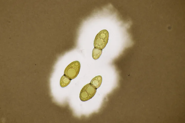 Foto yang diasosiasikan dengan Splanchospora ampullacea pada iNaturalist