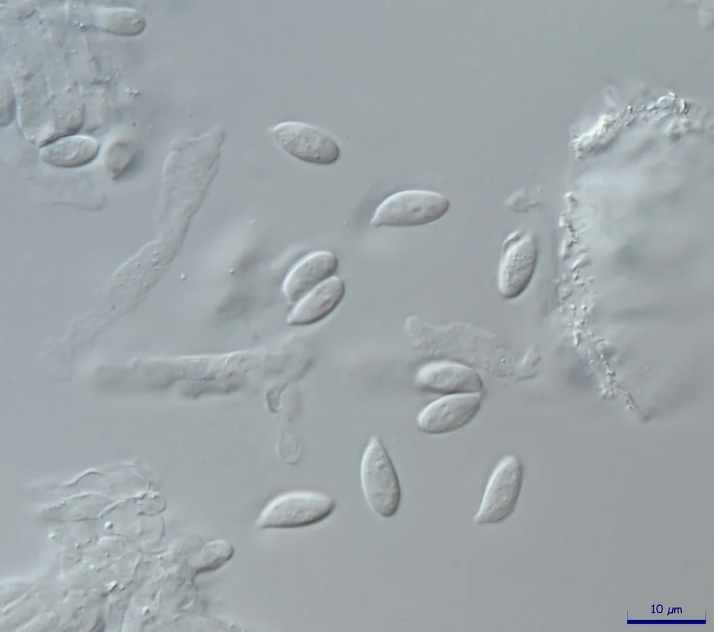 Mikrograf struktur yang diasosiasikan dengan Hemimycena hirsuta pada iNaturalist