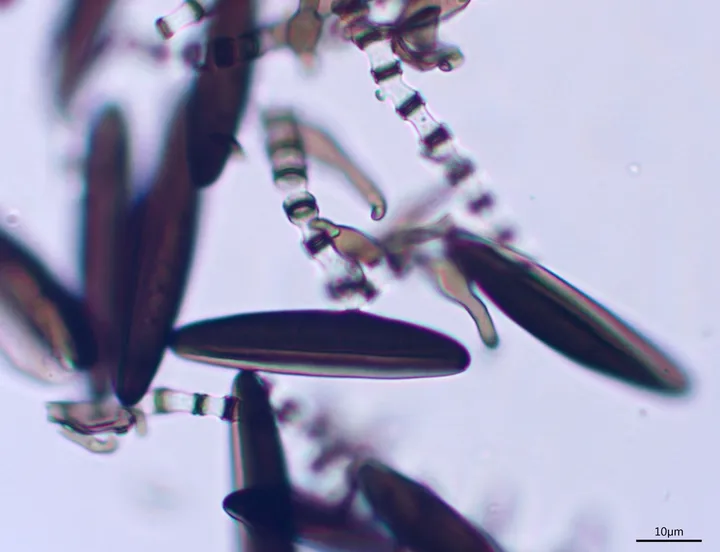 Foto yang diasosiasikan dengan Arthrinium caricicola pada iNaturalist