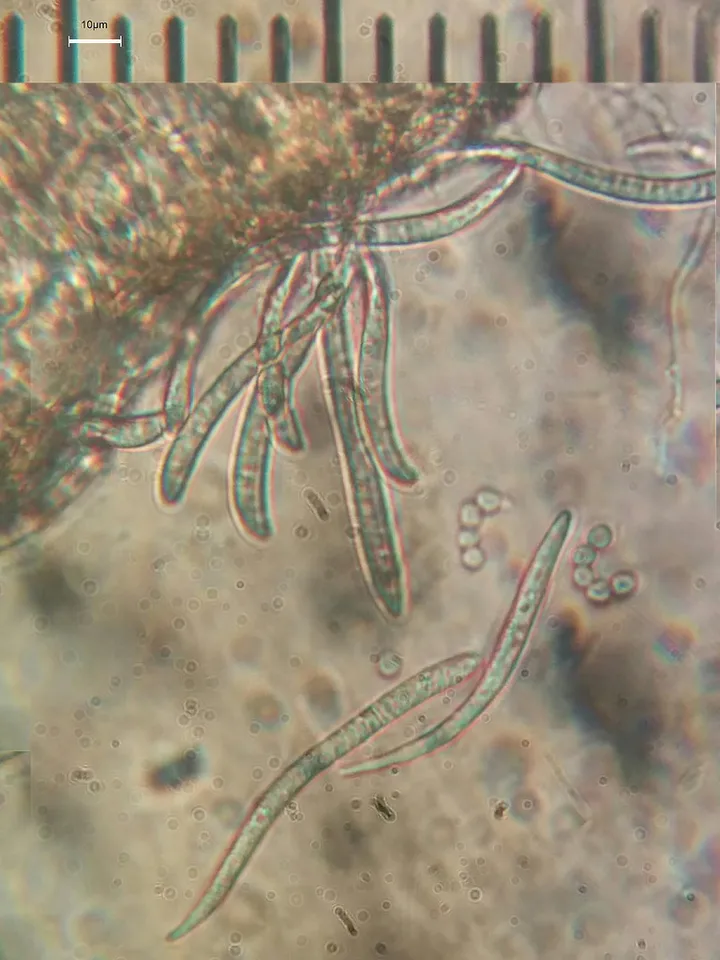 Mikrograf struktur Arctomia fascicularis menurut sumber