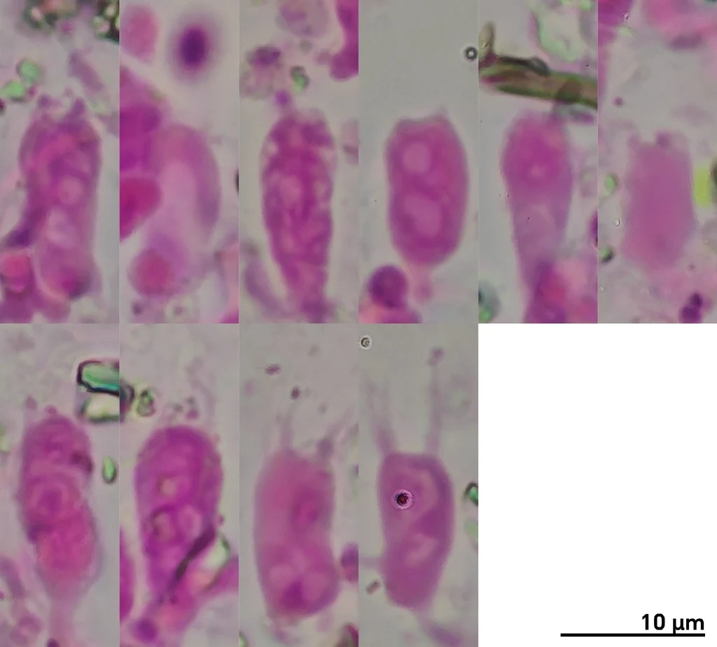 Mikrograf struktur yang diasosiasikan dengan Xenasma tulasnelloideum pada iNaturalist