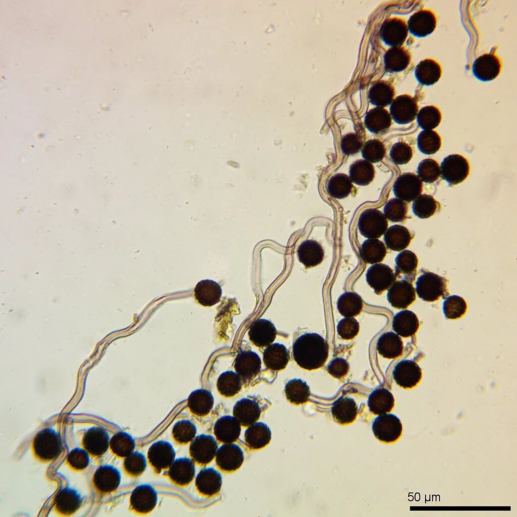 Mikrograf struktur yang diasosiasikan dengan Abstoma purpureum pada iNaturalist