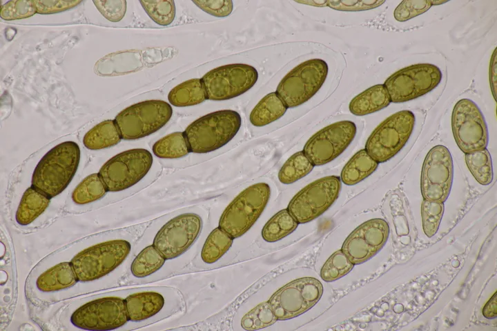 Foto yang diasosiasikan dengan Splanchospora ampullacea pada iNaturalist