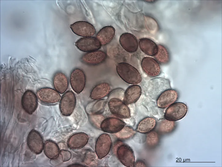 Mikrograf spora yang diasosiasikan dengan Cortinarius porphyroideus oleh sumber