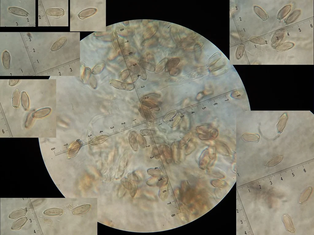 Mikrograf struktur yang diasosiasikan dengan Hysterangium neotunicatum pada iNaturalist